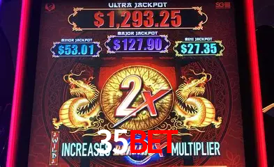 Recursos de Bônus 35bet